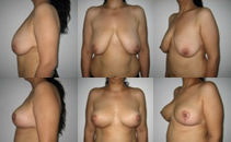 detalii ridicare caz#1